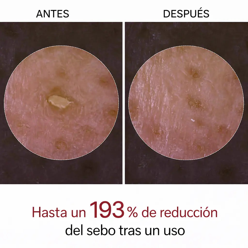 Peel Shot Coreano® – Piel más lisa y luminosa desde la primera aplicación