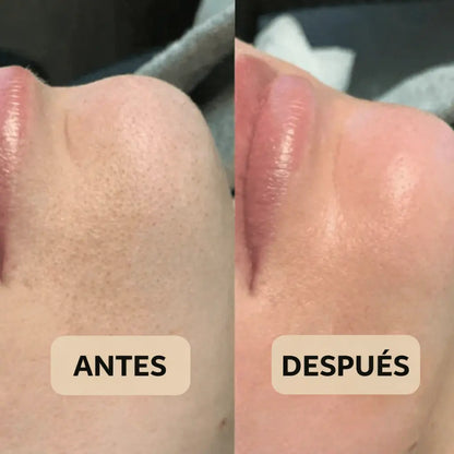 Peel Shot Coreano® – Piel más lisa y luminosa desde la primera aplicación