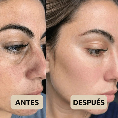 Peel Shot Coreano® – Piel más lisa y luminosa desde la primera aplicación