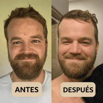 Peel Shot Coreano® – Piel más lisa y luminosa desde la primera aplicación